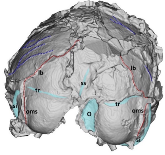 THE DNH7 ENDOCAST OF PARANTHROPUS ROBUSTUS & ENLARGED O/M SINUSES